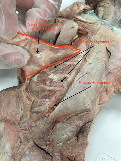 Internal Intercostals Cat