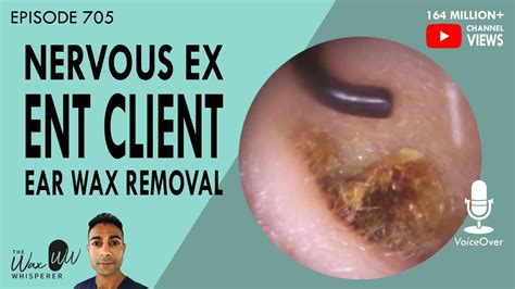 nervous  ent client ear wax removal youtube