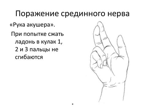 Плечевое сплетение - презентация онлайн