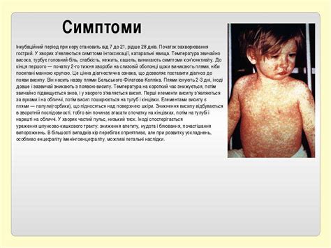 "Інфекційні хвороби" - презентація з медицини