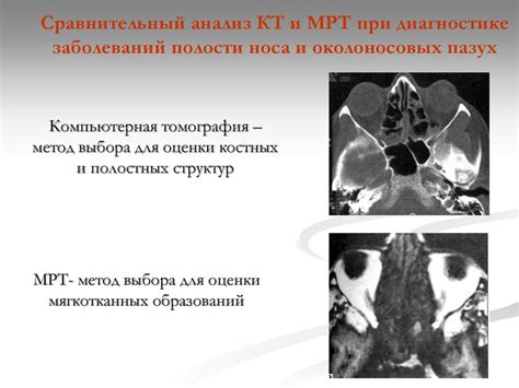 Хронические синуситы - презентация онлайн