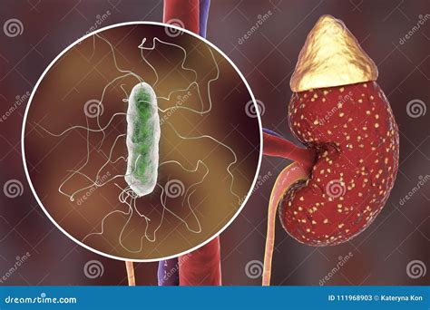 Proteus Mirabilis On Chromogenic Agar Stock Photography | CartoonDealer ...