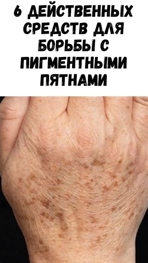 Одноклассники | Лечение рук, Журнал о здоровье, Домашнее лечение