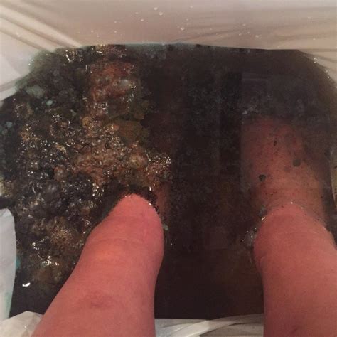 4 Benefits of Ionic Foot Bath | Ionic foot bath, Foot bath, Foot detox bath