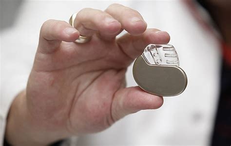 Кардіостимулятори | Імплантація однокамерних, двох каменрних та трьох ...