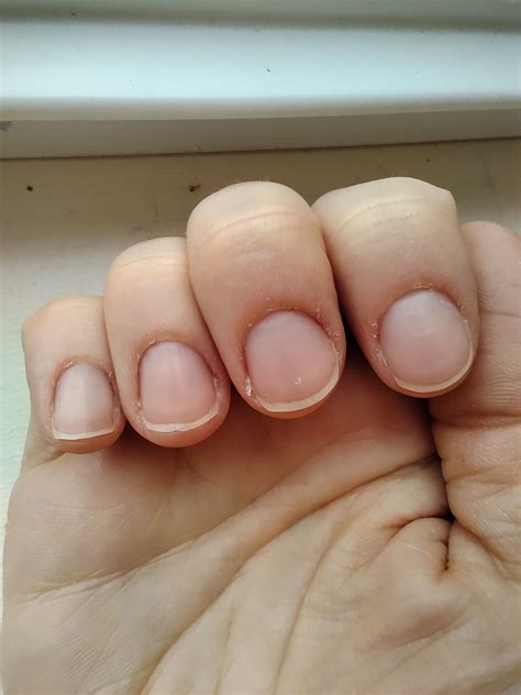 what's up with my lateral nail folds? : r/RedditLaqueristas