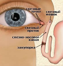 Дакриоцистит у новорожденных - что это, причины, диагностика и лечение
