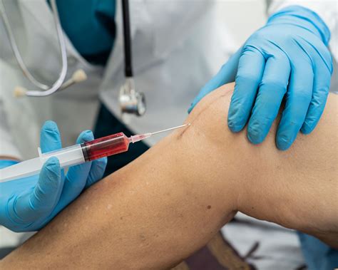 PRP Training for Joints & Tendon – PRP Pure (Platelet Rich Plasma