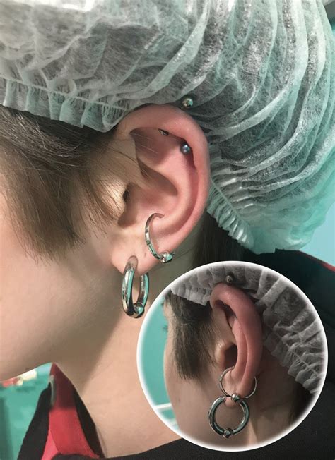 Прокол conch