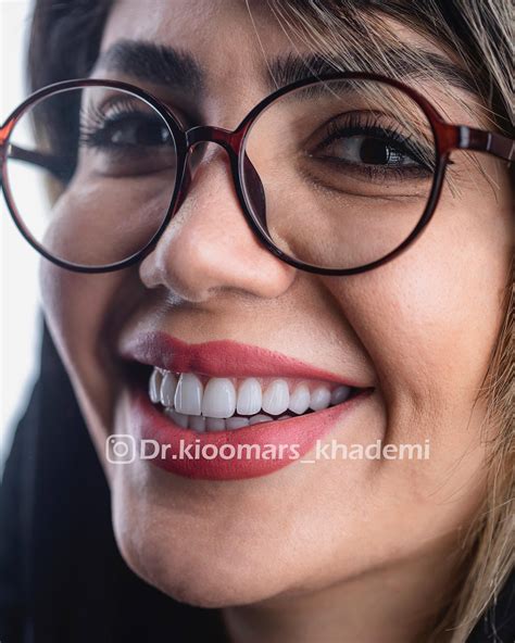 ‎دکتر کیو |دندانپزشک‎ (@dr.kioomars_khademi) • Instagram photos and videos