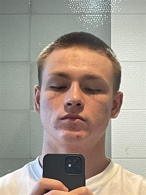 [anti ageing] deep lines under eyes down to my cheek. whats the cause ...