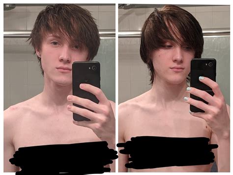 MTF. 2016 - Now (10.5 Months HRT) : r/transtimelines