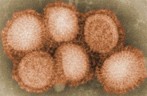 Chřipkový virus A – Wikipedie