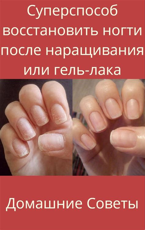 Как восстановить ногти после наращивания: способы, средства