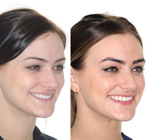 InfluencerGoneWild's Jaw-Dropping Transformation: Before & After  You HAVE To See This Image 18