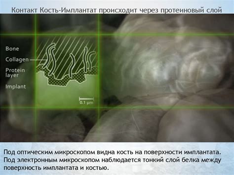 Остеопороз и имплантация - презентация онлайн