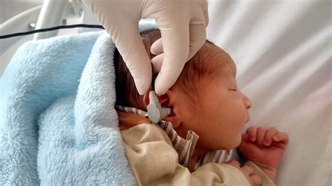 Quando Fazer Teste Da Orelhinha - Conheça a importância do teste da orelhinha | | Hospital São Francisco