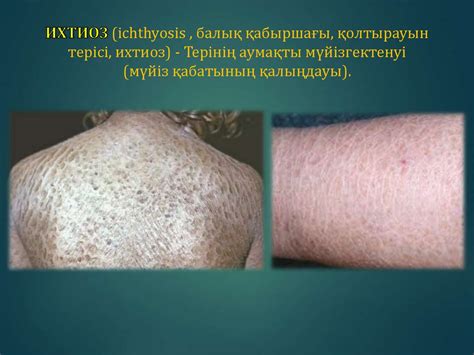 Мутация және мутация түрлері - презентация онлайн