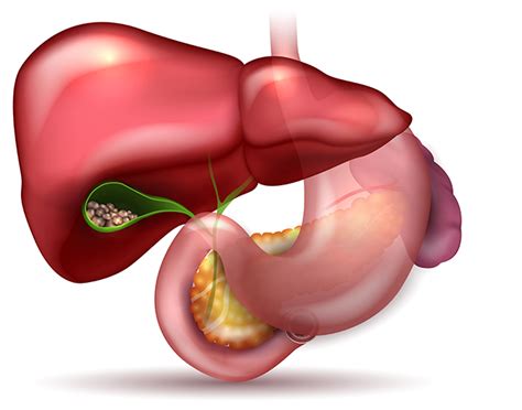 gallbladder surgery kh ng surgery