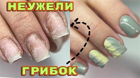 Пожелтели ногти 😐 Неужели грибок? Вязаный дизайн ногтей 💅Маникюр - YouTube