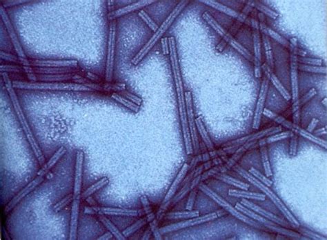 Tobacco mosaic viruses, that cause plant diseases worldwide. | Plant ...