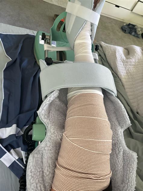 Got ACL surgery on Thursday. Day 3. Bone tendon bone : r/ACL