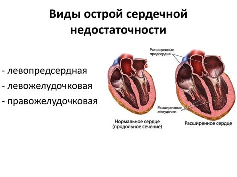 Недостаточность кровообращения: принципы фармакотерапии ...