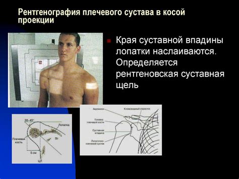 Переломы плечевой кости - презентация онлайн