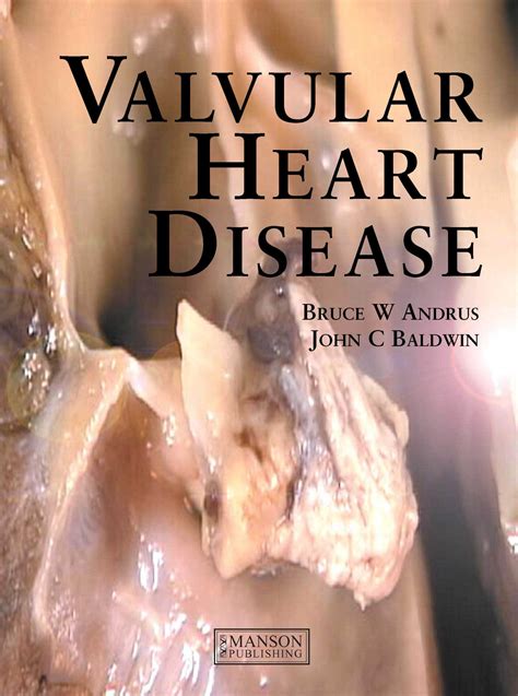 Valvular Heart Disease | Εκδόσεις Κωνσταντάρας