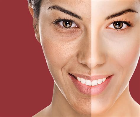 Unlocking Radiant Skin The Fortson Dermatology Anchorage Difference