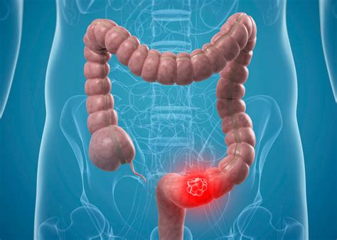 Gastrointestinal Surgery in Abu Dhabi | Burjeel Medical City