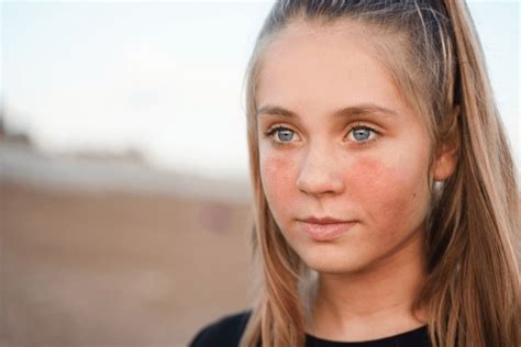 thousand burnt face royalty  images stock  pictures