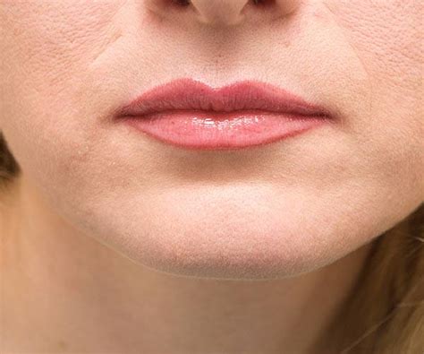 Lip Reduction Surgery | Cape Town