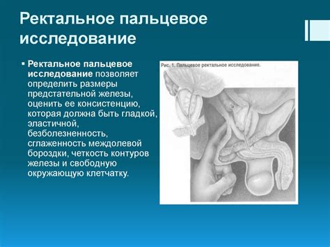 Аденома предстательной железы - презентация онлайн