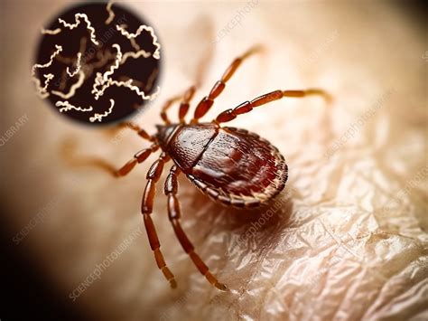 Tick transmitting Lyme disease, illustration - Stock Image - F037/8437 ...