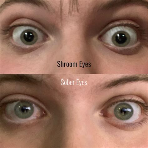 Pupils become massively dilated on shrooms. Easy way to check if you’re