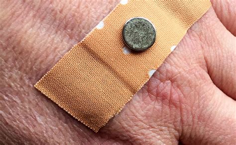 Können Neodym Magnete heilen und in der Medizin unterstützen?
