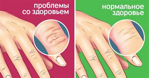 Проблемы со здоровьем