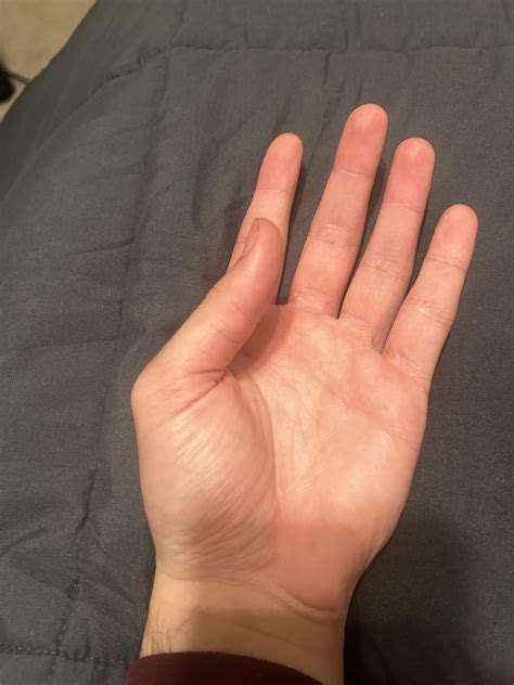 Scared of hand atrophy and thumb twitching : r/AskDocs