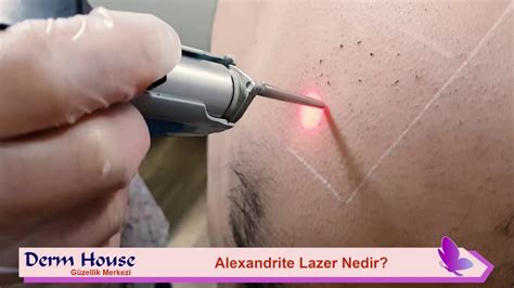 Alexandrite Lazer Epilasyon Cihazının Özellikleri Nelerdir? - YouTube