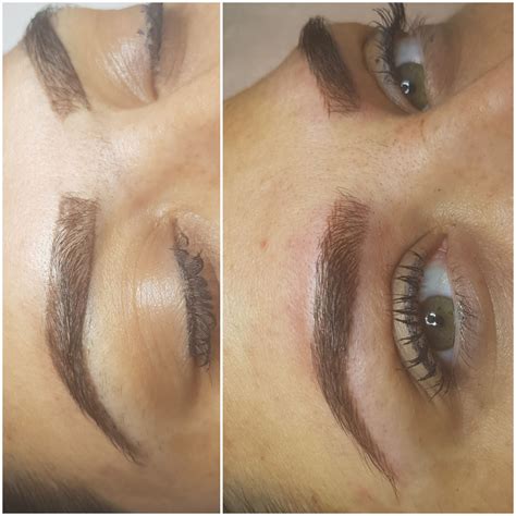 Customers at laseraway nyc share their amazing transformations 31