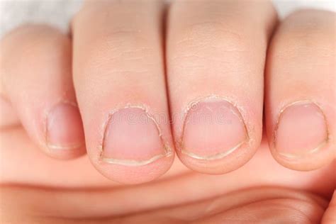 Men Long Fingernails Stock Photos - Free & Royalty-Free Stock Photos ...