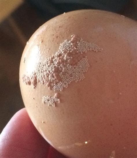 I now know these are calcium deposits, but that doesn’t mean I have to