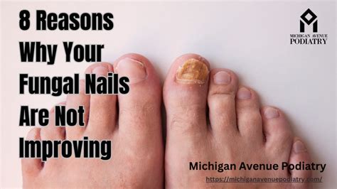 8 Reasons Why Your Fungal Nails Are Not Improving