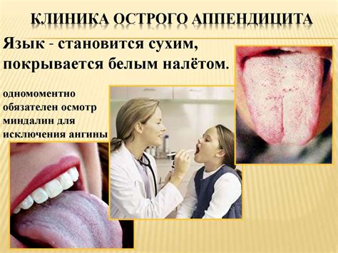 Острый аппендицит - презентация онлайн