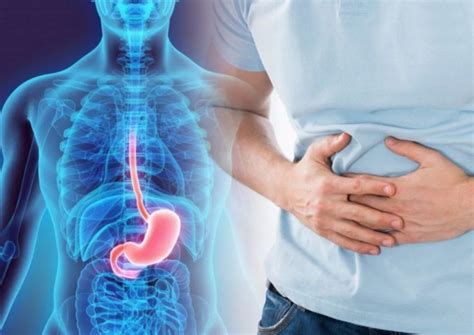 Рефлукс - какво трябва да знаем за него — Medconsult.bg
