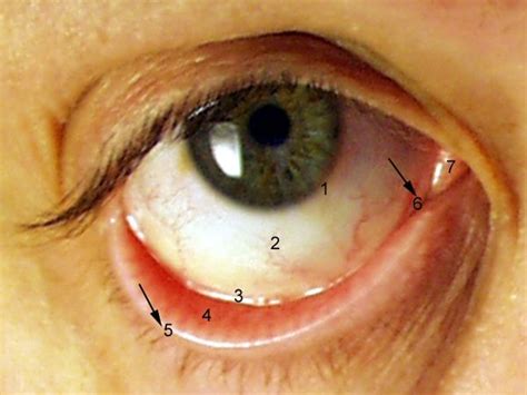 Conjuntiva - Viquipèdia, l'enciclopèdia lliure | Enciclopedias