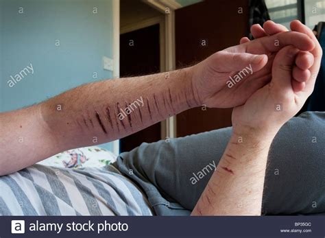 Extremely depressed young man self harming and suicidal Stock Photo ...