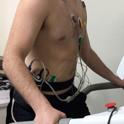 Exercise Stress Test or Stress ECG (Electrocardiograph) - HeartWest