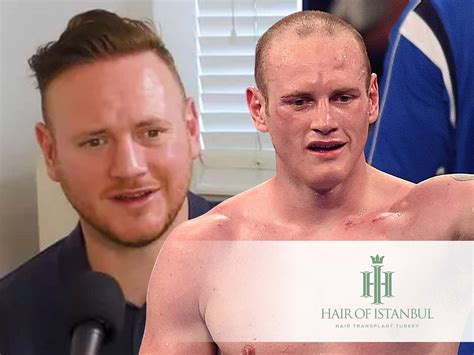 george groves hair transplant fighting hair loss head